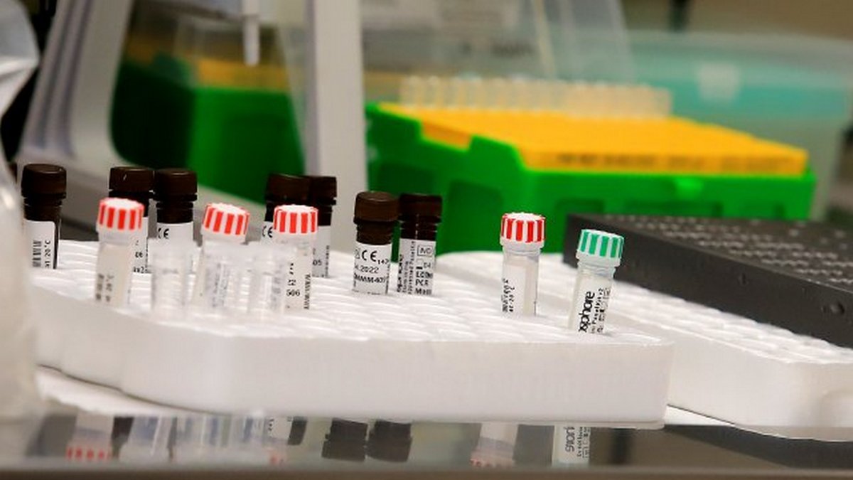 Чому перед вакцинацією проти Covid-19 важливо зробити ПЛР-тест?
