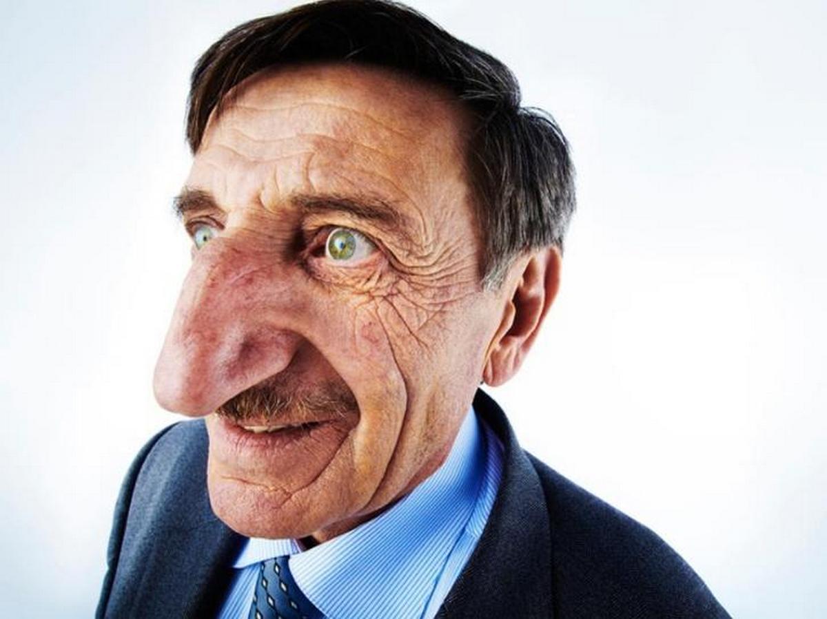 71-year-old Turk with the longest nose in the world (Photo)