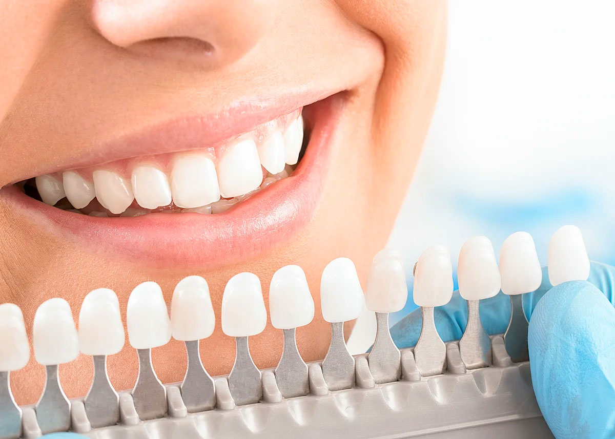 Стоматолог назвав 7 речей, які допоможуть зробити зуби білими