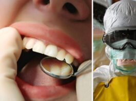 Стоматолог повідомив, що ковід руйнує зуби