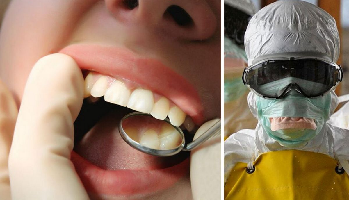 Стоматолог повідомив, що ковід руйнує зуби