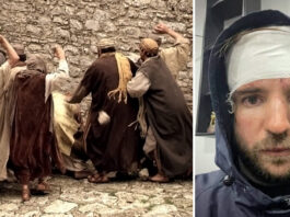 Російського туриста в Єгипті закидали камінням, мало не вбивши