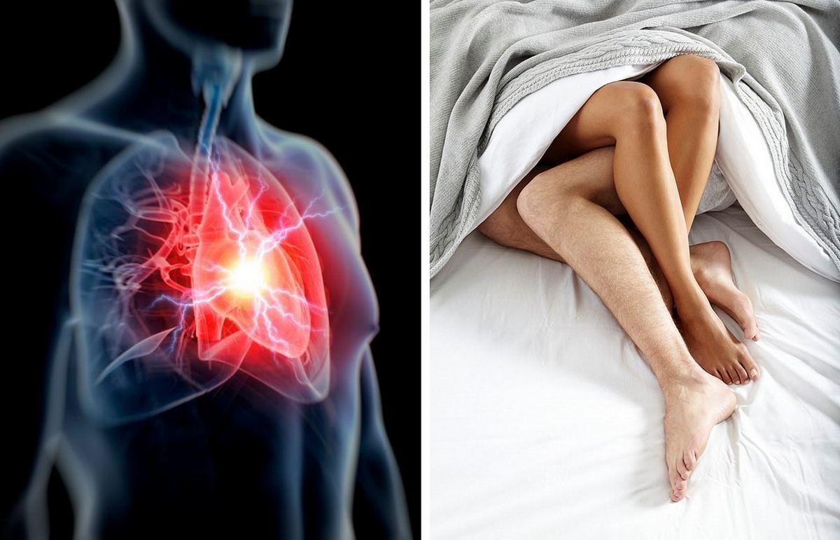 Вчені встановили частоту смерті від серцевого нападу під час сексу