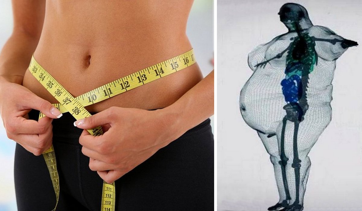 Вчені встановили психологічні типи людей, які схильні до надмірної ваги