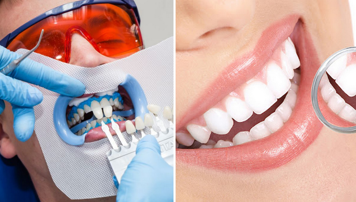 Стоматолог розповіла, як чистити і що їсти, щоб зуби сяяли білизною