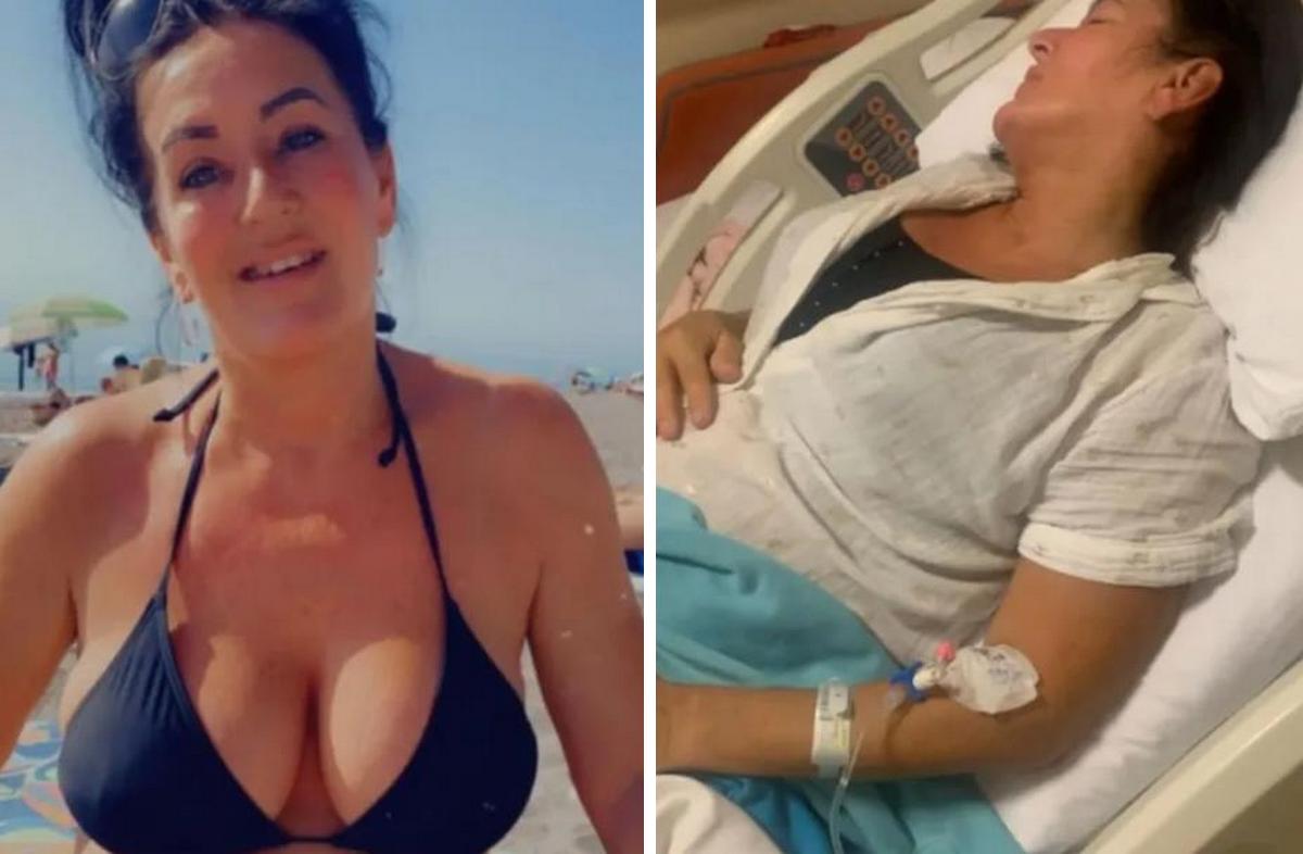 У британської туристки відвалилися груди після операції в Туреччині