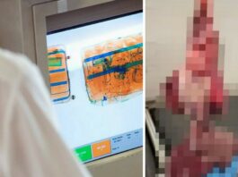 Митники аеропорту були шоковані, коли виявили у валізі у туристів травну систему