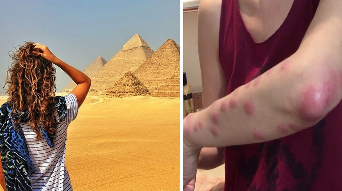 Клопи дісталися курортів Єгипту: у Хургаді через них отруїлися туристи